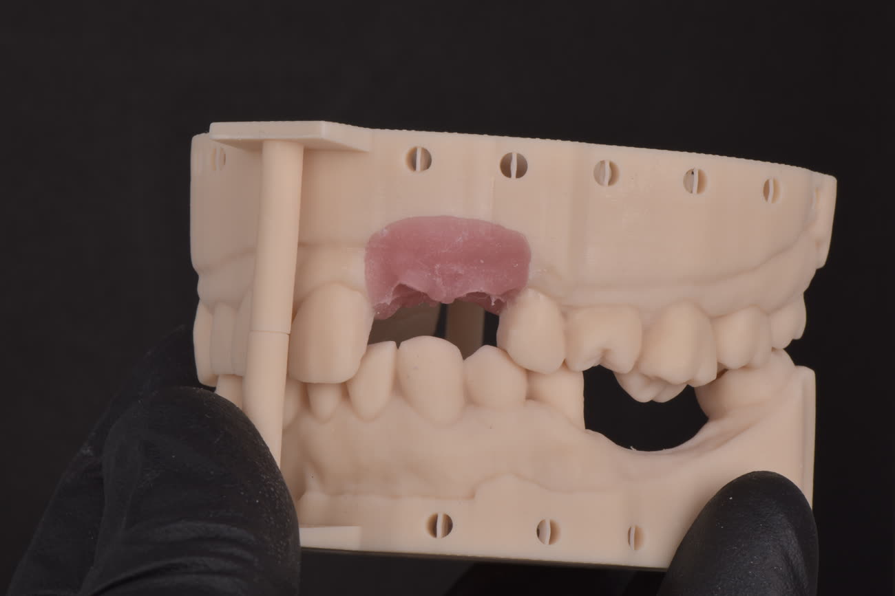 A model printed in the lab, used to plan and verify a case before the final restoration.