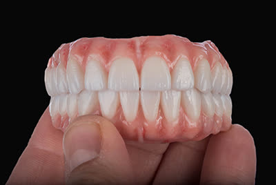 Finished full-arch restoration, Roshen Dental Lab