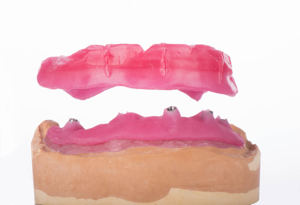 All-on zirconia bridge, bite block on model